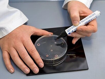 Eine Person beschriftet eine Petrischale mit einer Probe.